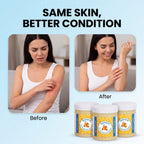 Sanora - Steroid Free Balm For Eczema & Psoriasis