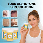 Sanora - Steroid Free Balm For Eczema & Psoriasis